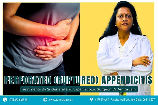 Dr Amita Jain best surgeon for Perforated Ruptured Appendicitis